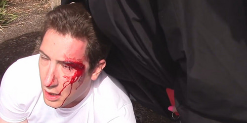 Antifa bashed Ryan Fletcher Antifa bashed Ryan Fletcher